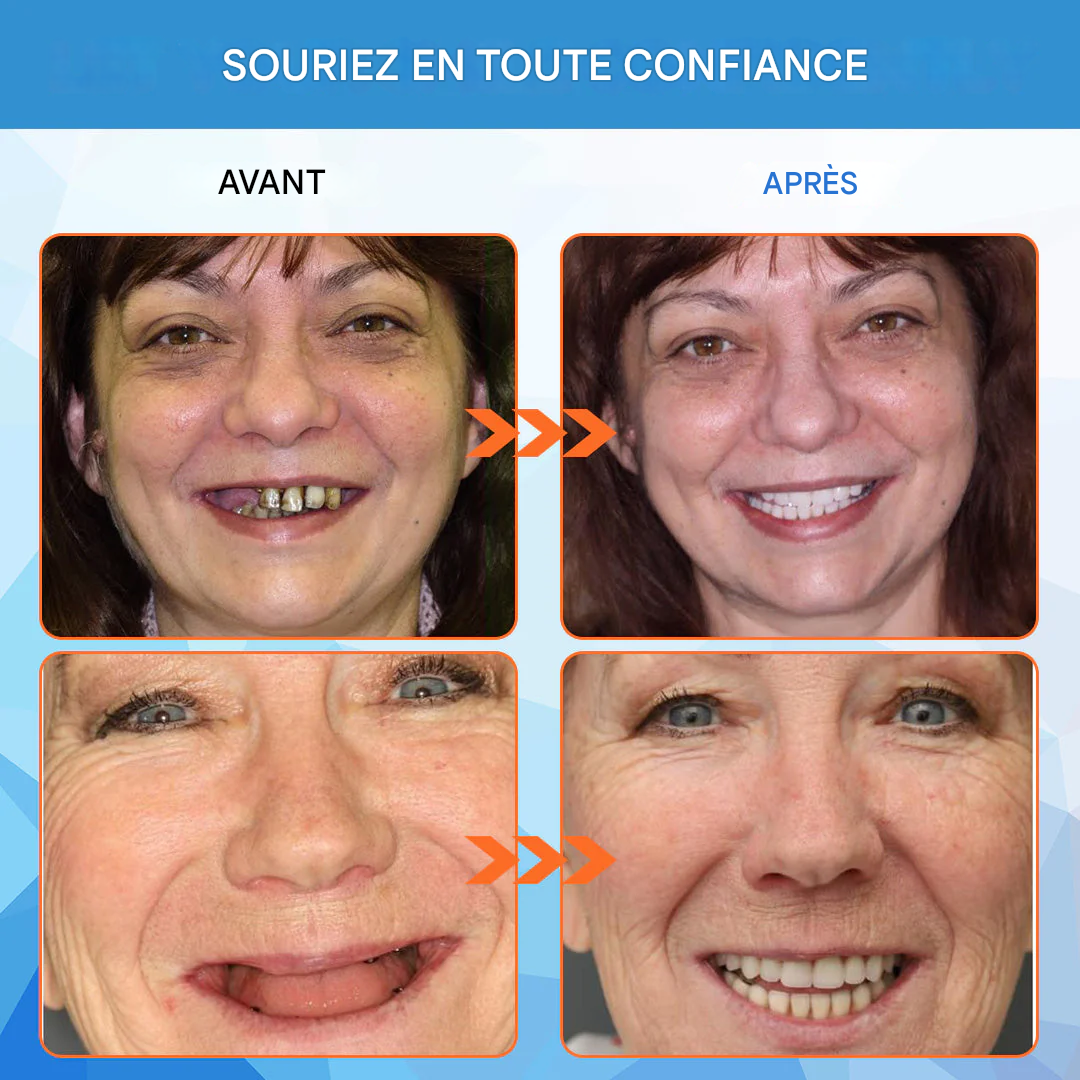 Coeurva® Prothèse complète médicale à forte puissance d’adhésion | Fabriquée et livrée depuis l’Allemagne 🍀✅ Pas de jeu, pas de douleur