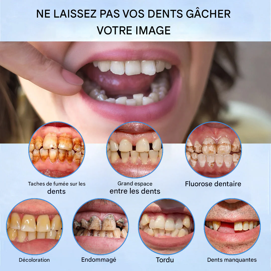 Coeurva® Prothèse complète médicale à forte puissance d’adhésion | Fabriquée et livrée depuis l’Allemagne 🍀✅ Pas de jeu, pas de douleur