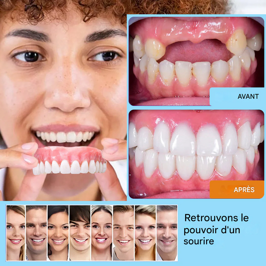 Les dentistes recommandent vivement – prothèses dentaires en céramique pour seniors 🦷 la deuxième paire à moitié prix 🔥 nous conseillons d’en acheter deux paires en réserve 🎁